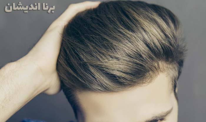 روش های مراقبت از مو در مردها