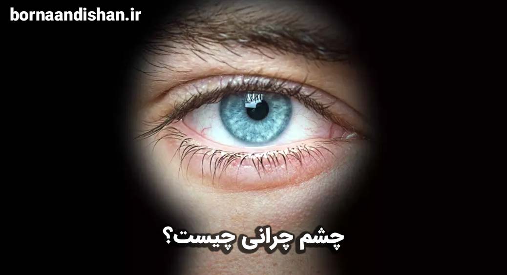 اختلال چشم چرانی چیست؟