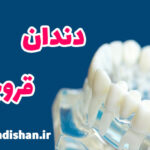 دندان قروچه کودکان چگونه درمان می شود؟