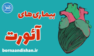 کارگاه پزشکی بیماری های آئورت