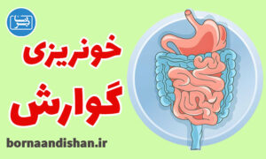کارگاه پزشکی خونریزی دستگاه گوارشی فوقانی
