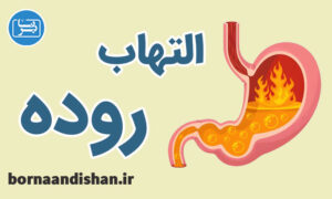 کارگاه پزشکی بیماری های التهابی روده
