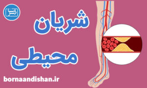 کارگاه پزشکی بیماری شریان محیطی