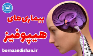 کارگاه پزشکی بیماری های هیپوفیز