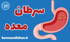 کارگاه پزشکی تشخیص سرطان معده