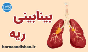 کارگاه پزشکی بیماری بینابینی ریه