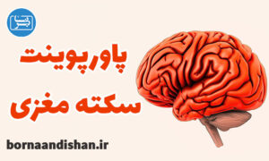 پاورپوینت سکته مغزی