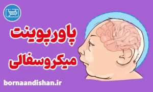 پاورپوینت بیماری میکروسفالی