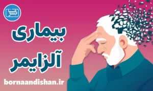 کارگاه پزشکی بیماری آلزایمر