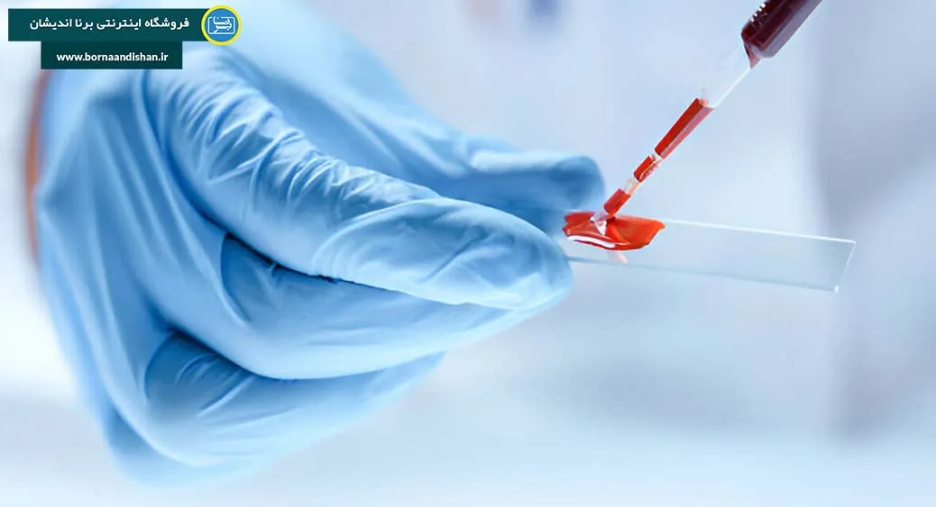آزمایش خون: پنجره‌ای شفاف به سوی رازهای نهفته در بدن شما