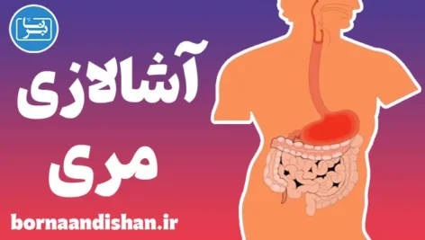 آشالازی مری: بررسی کامل و تخصصی