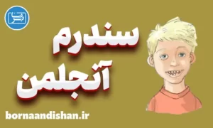 پاورپوینت سندرم آنجلمن