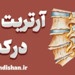 آرتروز در ستون فقرات کمری: تشخیص و درمان