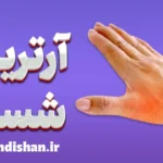 آرتریت انگشت شست: تشخیص و درمان