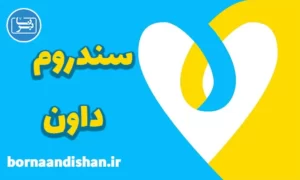 پاورپوینت سندروم داون