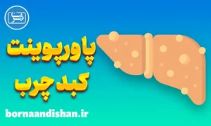 پاورپوینت کبد چرب