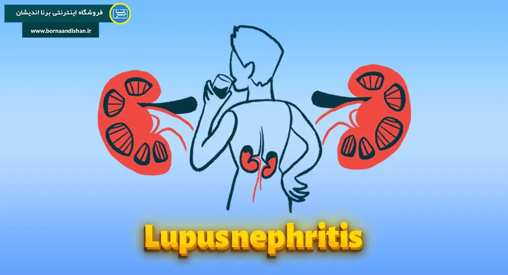 درمان نفریت لوپوس