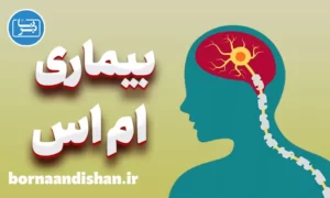 پاورپوینت بیماری ام اس