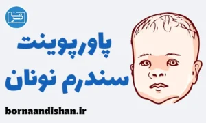 پاورپوینت سندرم نونان