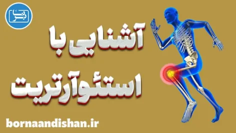 استئوآرتریت: راههای مقابله با آرتروز