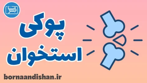 پوکی استخوان: راهنمای کامل پیشگیری و درمان