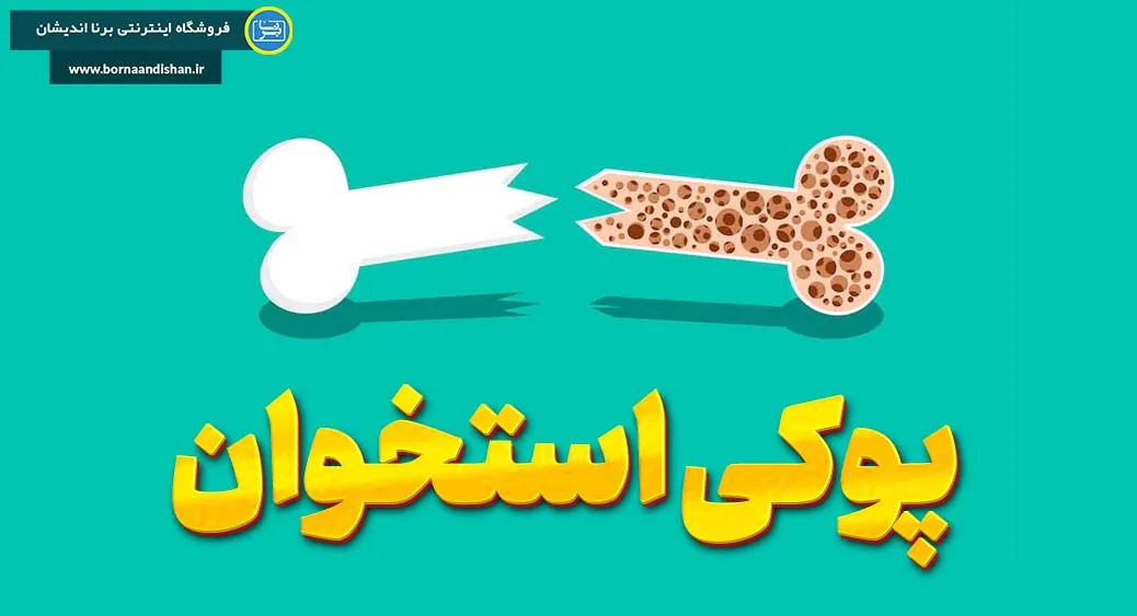 تشخیص و درمان پوکی استخوان