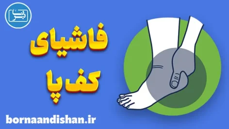 التهاب فاشیای کف پا: نکات مهم برای کاهش درد