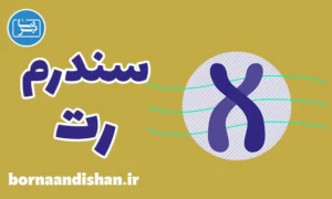 پاورپوینت سندرم رت