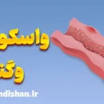 واسکولیت وگنر: از تشخیص تا درمان