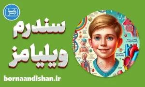 پاورپوینت سندرم ویلیامز