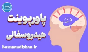 پاورپوینت بیماری هیدروسفالی