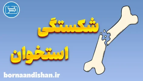 شکستگی استخوان: از پیشگیری تا درمان