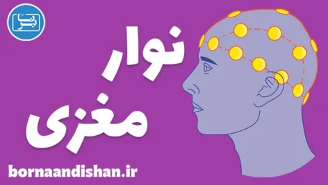 نوار مغزی: بررسی دقیق سلامت مغز