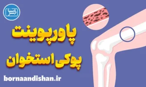 پاورپوینت پوکی استخوان
