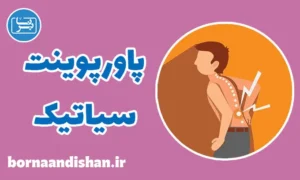 پاورپوینت سیاتیک