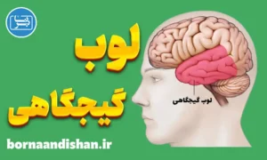 پاورپوینت لوب گیجگاهی