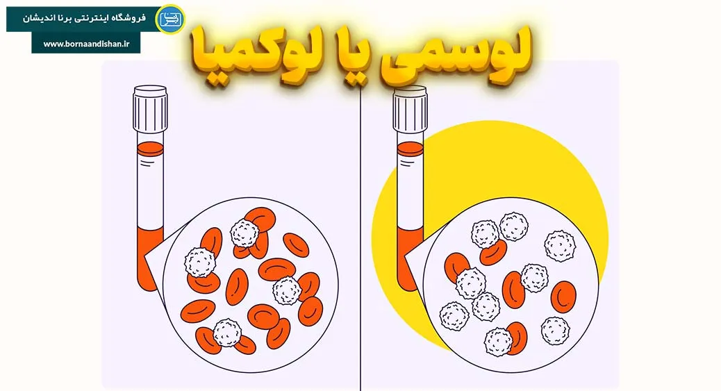 رازهای نهفته در پشت پرده سرطان خون | لوسمی: آنچه باید بدانید!