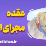 عقده مجرای ادرار؛ راهنمای جامع شناخت و درمان