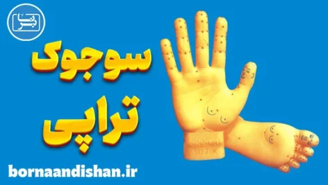 پکیج آموزش قدم به قدم سوجوک تراپی
