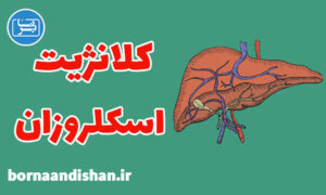 کارگاه پزشکی كلانژيت اسكلروزان اوليه