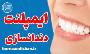 پکیج آموزش ایمپلنت و دندانسازی